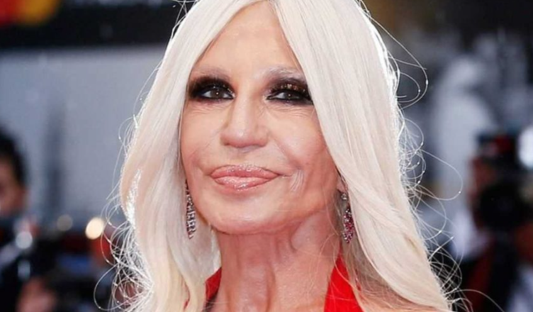 How did Donatella Versace Look Before Her Multiple Plastic Surgery Procedures? How did Donatella Versace Look Before Her Multiple Plastic Surgery Procedures?