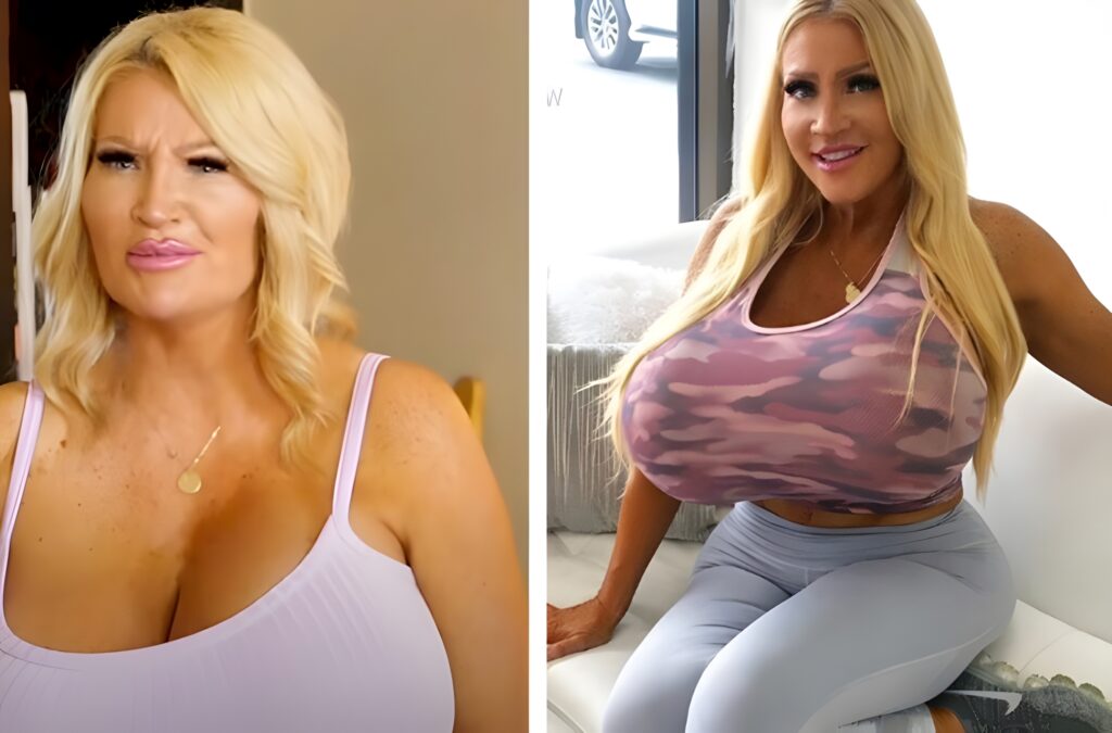 The model with the most peculiar shapes is this woman’s appearance prior to plastic surgery.