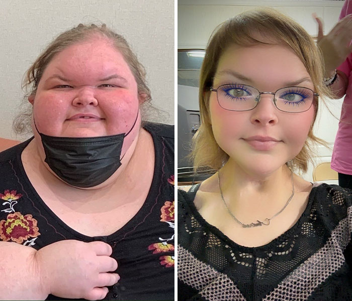 From 717 Pounds on Life Support to This Poolside Revelation!