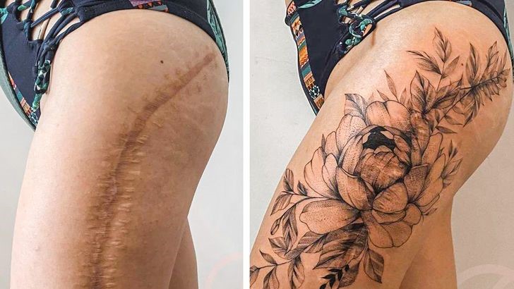 16 Stunning Tattoo Cover-Ups That Honor Healing: Transforming Scars Into Art